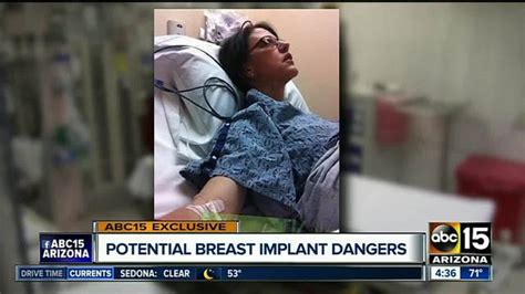 did breast implants make valley woman sick abc15 arizona
