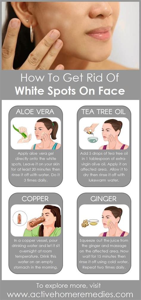 Natural Ways To Get Rid Of White Spots On Skin Women Fitness Magazine