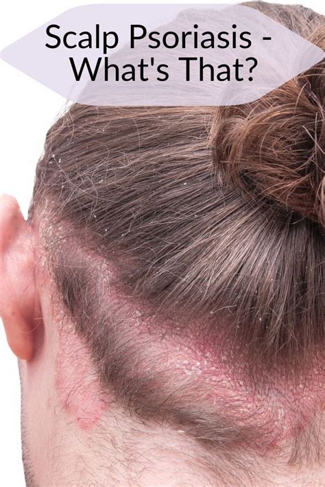 Pin On General Natural Hair Care Tips