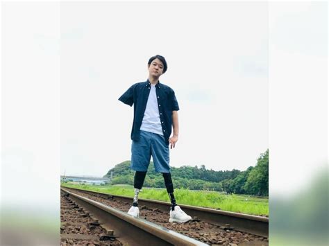 【写真・画像】 山田千紘さん、電車に轢かれ手足を失った日「深夜から朝までの大手術だった」 1枚目 話題 Abema Times アベマタイムズ