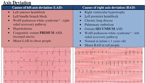 Medical Education Causes Of Axis Deviation On Ecg
