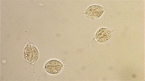 Trichomonas Vaginalisis Trophozoite In Urine Sample Under Microscope