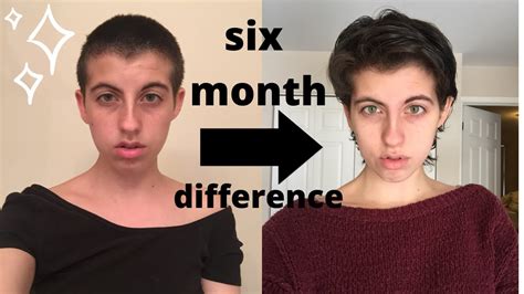 Six Months After Shaving My Head No Trims Pics Youtube