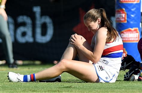 women five times more likely to tear acl au