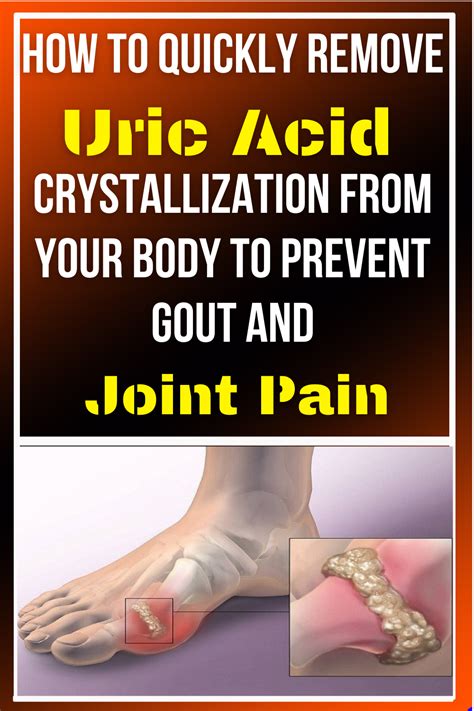 How To Prevent Gout Naturally