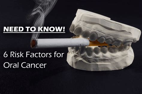 Need To Know 6 Risk Factors For Oral Cancer News From John J Kelly