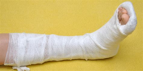 When To Fix A Broken Ankle Huffpost
