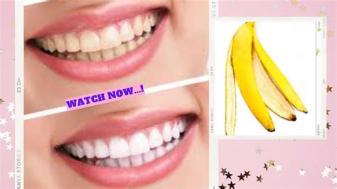 Makeuphow To Whiten Your Teeth Naturally At Home In 1 Minute Get