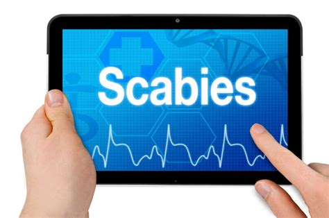 10 Signs Of Scabies Facty Health
