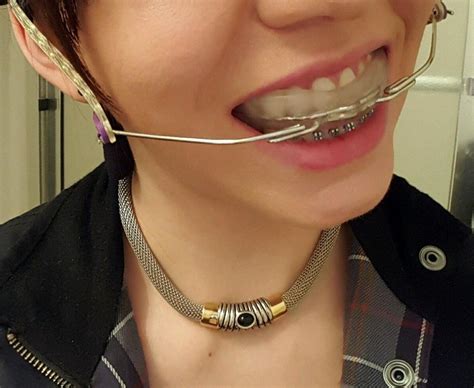 braces girlswithbraces metalbraces headgear braces girls dental braces metal braces