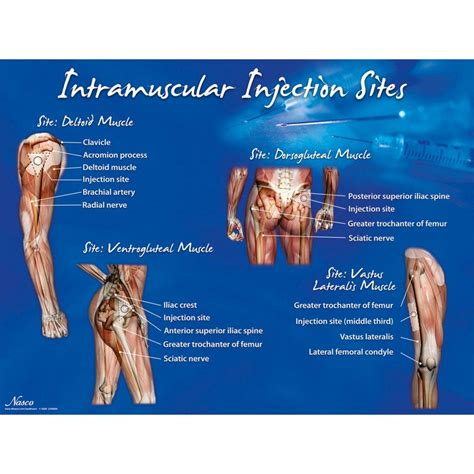 Intramuscular Injection Sites Poster SEM Trainers