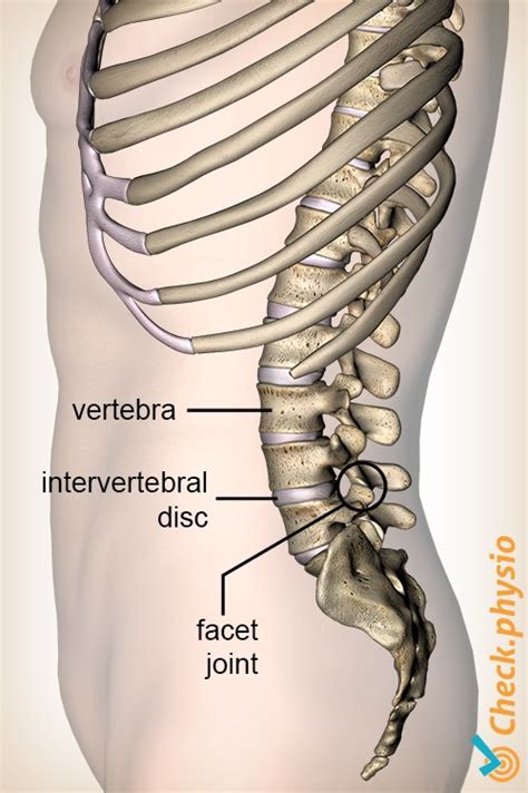 Lumbar Facet Syndrome Physio Check