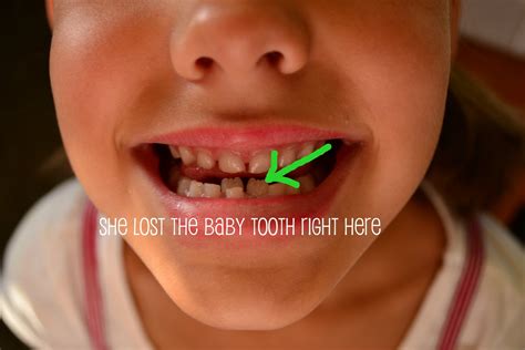 How to pull out a loose tooth without pain? Rice and Shine: September 2011