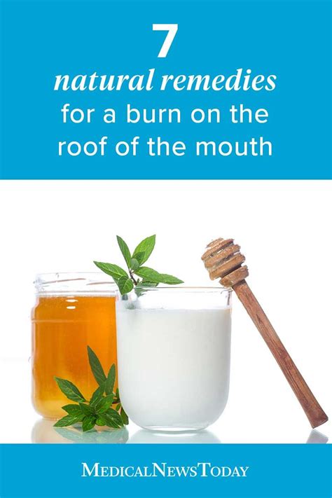 Burning The Roof Of The Mouth Is A Common Problem But It Is Easy To