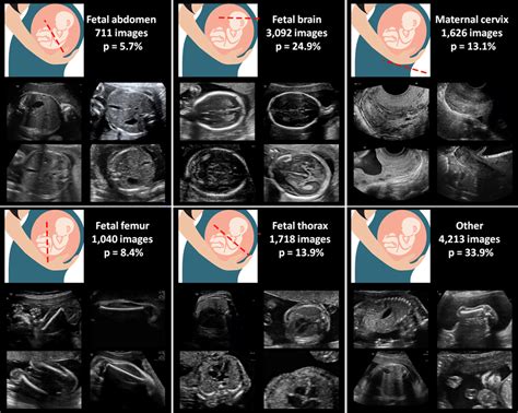 Maternal Fetal Us Categories From Our Dataset Image Examples Total