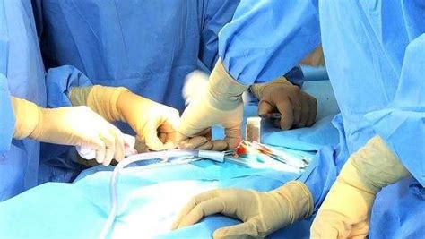 Close Up Hands Wearing Surgical Gloves Of Operating Team Wearing