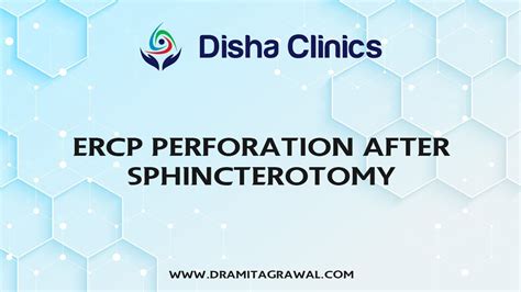 Ercp Perforation After Sphincterotomy Youtube