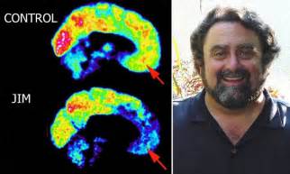 Meet The Neuroscientist And Married Father Of Three Who Discovered He