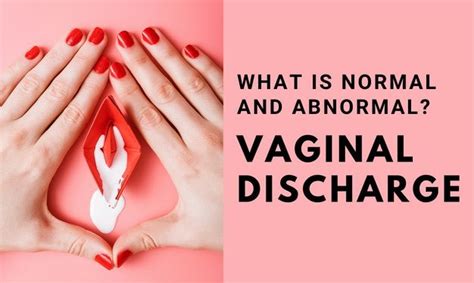Vaginal Discharge What Is Normal What Is Not R Sexeduforall