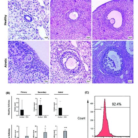 Histological Evaluation Of Primary Secondary And Antral Follicles