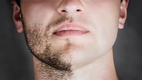 ¿te Acuerdas Cómo Era Tu Cara Sin Barba El Nuevo Filtro ‘no Beard Te