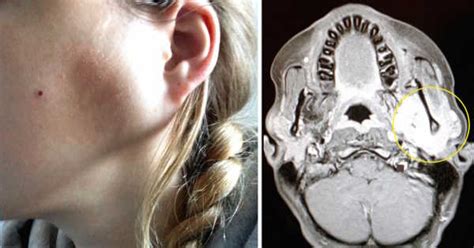 Teen Has Throbbing Bump In Jaw But Dentist Insists It Has Nothing To