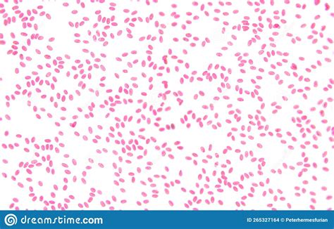 Fish Blood Smear Erythrocytes With Micronucleus X Light Micrograph Stock Photo Image Of