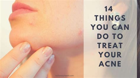 14 Things You Can Do To Treat Your Acne By The Way Health