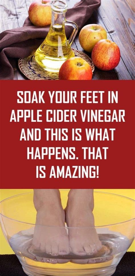 Soak Your Feet In Apple Cider Vinegar And This Is What Happens That Is