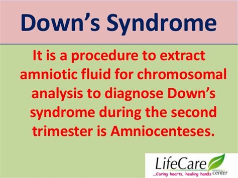 Downs Syndrome Nipt Or Niftyvis The Best Sharda Jainamniocentesis