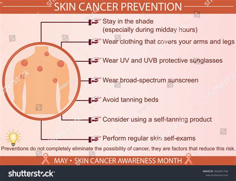 Skin Cancer Disease Prevention Infographic Vector Stock Vector Royalty