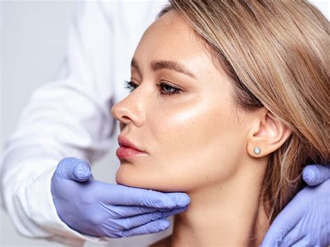 How To Get A Cheek Lift With Fillers Non Surgical Cheek Lift Cheek