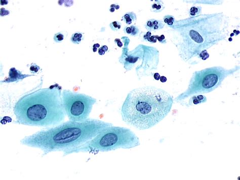 Cytopathology Of The Uterine Cervix Digital Atlas