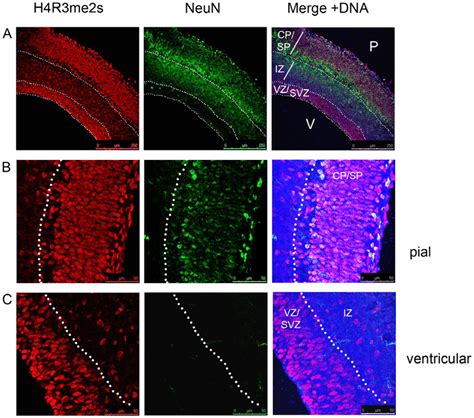 H4r3me2s Is Found In The Neurons And In The Ventricular Zone Of The