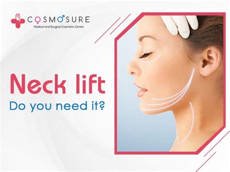 Should You Get A Neck Lift Surgery Cosmosure Clinic