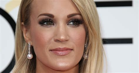 Carrie Underwood Shows Half Her Face Months After Needing Free