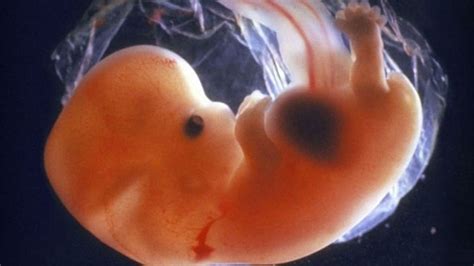 Entidad Del Embrión Humano Infofamilialibre