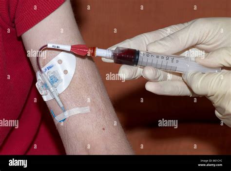 Taking Blood From A Picc Line Peripherally Inserted Central Catheters