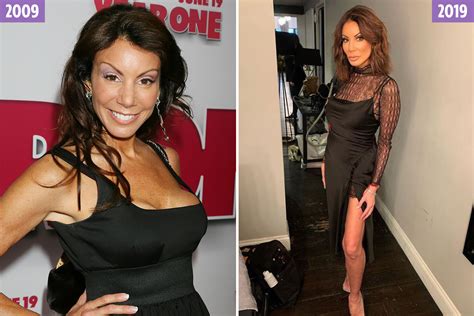 Real Housewives Of New Jersey Star Danielle Staub Has Breast Implants