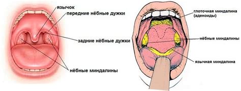 Как выглядит красное горло ребенка