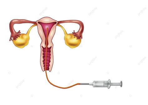 Fondo Inseminaci N Artificial Vagina Clip Salud Foto E Imagen Para