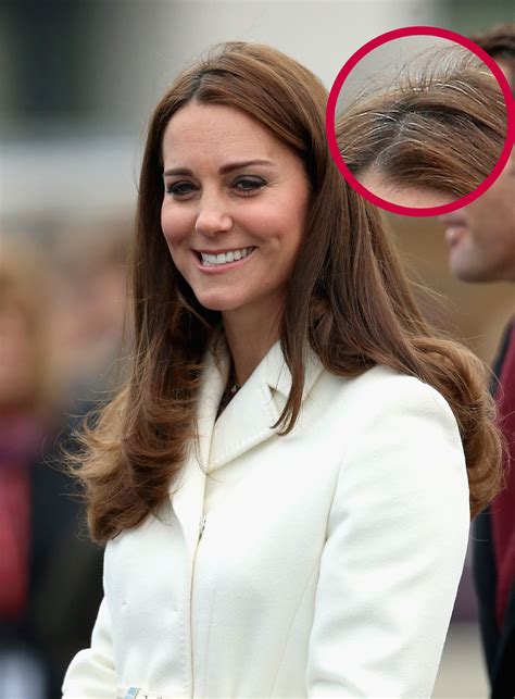 Kate Middleton Gray Hair