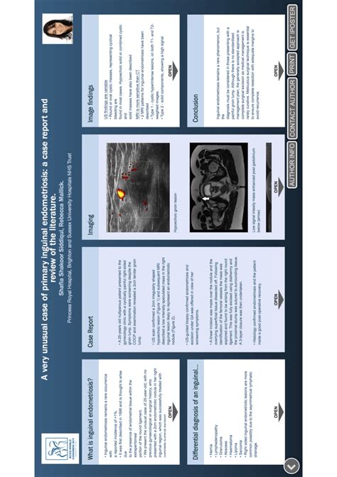 Pdf A Very Unusual Case Of Primary Inguinal Endometriosis A Case