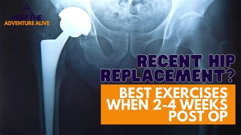 Best Exercises For Hip Replacement Surgery 2 4 Weeks Post Op Dr