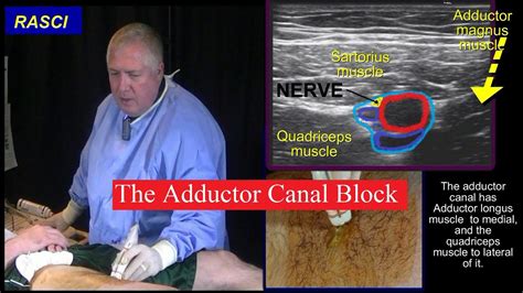 Adductor Nerve Block