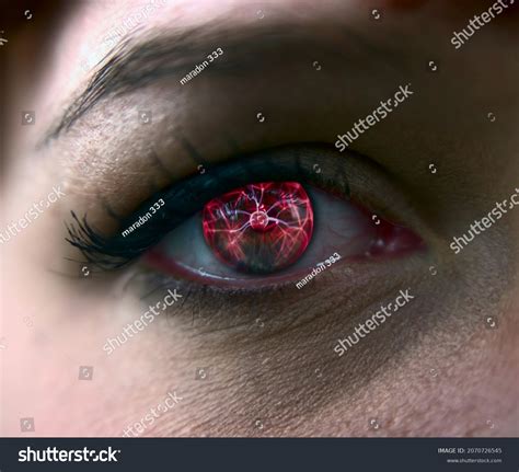 Woman Burst Blood Vessel Eye Closeup Stock Photo 2070726545 Shutterstock