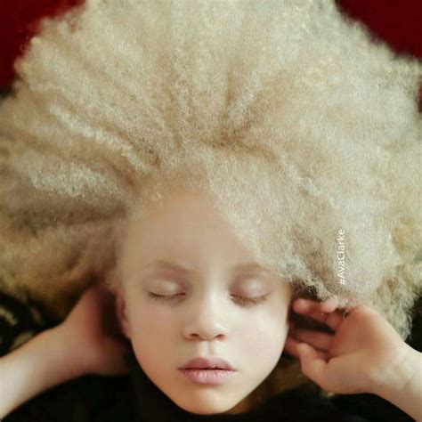 You Ll Be Amazed By These Albino People And Their Unique Beauty Pics