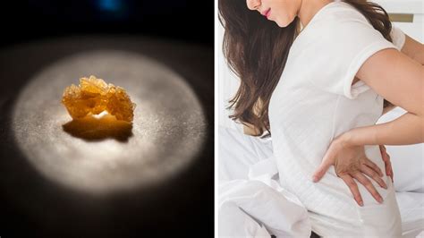 Lack of water in our body, the formation of excessive acid in the urine, urinary tract infections, etc. Kidney Stone Symptoms and Causes All Women Should Know ...