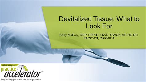Devitalized Tissue What To Look For Woundsource