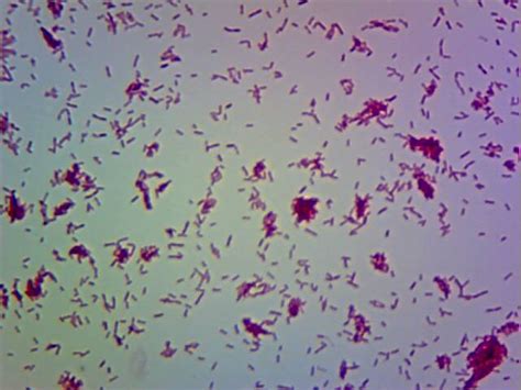 Bacteria Gram Neg Bacilli Wards 01 Clareandben Flickr
